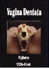 Vagina Dentata